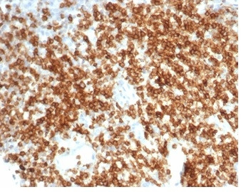 CD6 (Negative Marker of T-regulatory Cells) Antibody in Immunohistochemistry (Paraffin) (IHC (P))