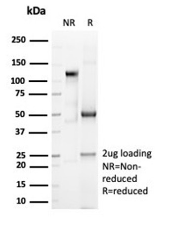 CD6 (Negative Marker of T-regulatory Cells) Antibody in SDS-PAGE (SDS-PAGE)