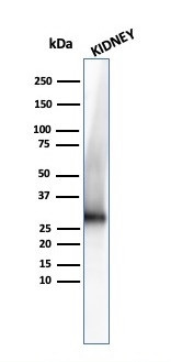 Adiponectin (Marker of Obesity) Antibody in Western Blot (WB)