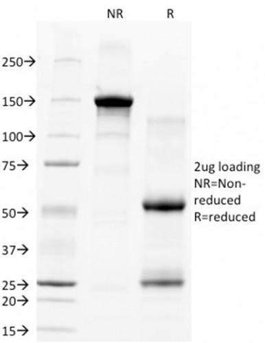 CD28 Antibody in SDS-PAGE (SDS-PAGE)