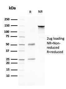 CD80 (B7-1) Antibody in SDS-PAGE (SDS-PAGE)