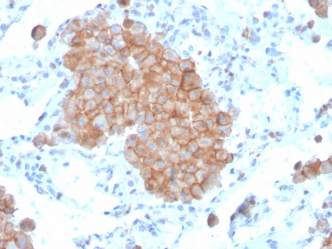 CD86 (Dendritic Cells Maturation Marker) Antibody in Immunohistochemistry (Paraffin) (IHC (P))