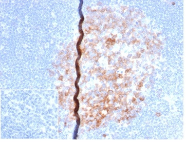 CD86 (Dendritic Cells Maturation Marker) Antibody in Immunohistochemistry (Paraffin) (IHC (P))