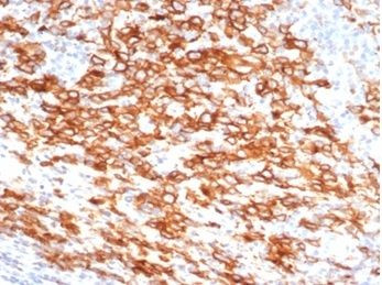 CD30/TNFRSF8 Antibody in Immunohistochemistry (Paraffin) (IHC (P))