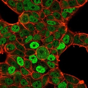 QKI/Protein Quaking Antibody in Immunocytochemistry (ICC/IF)