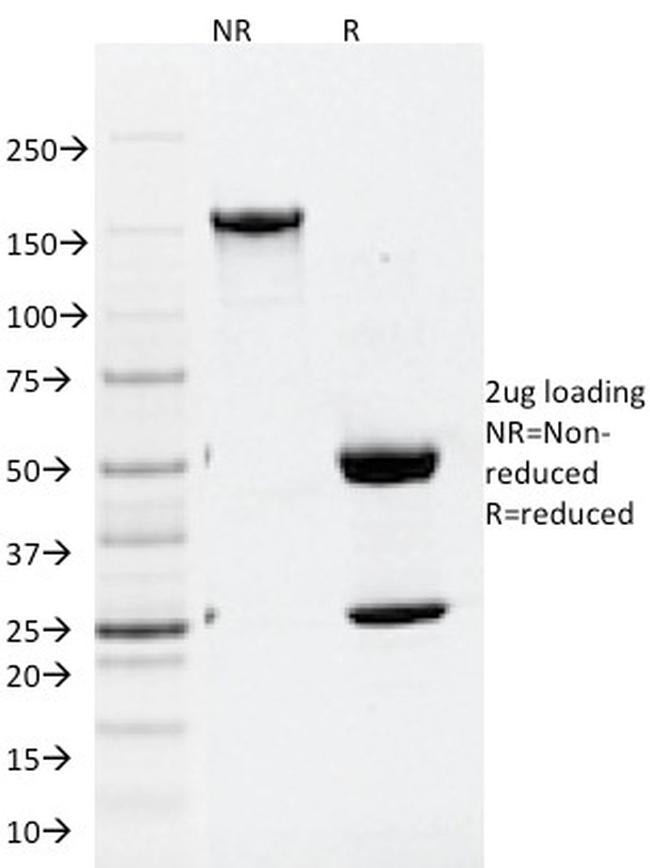 ATG5 Antibody in SDS-PAGE (SDS-PAGE)