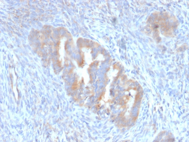 ATG5 Antibody in Immunohistochemistry (Paraffin) (IHC (P))