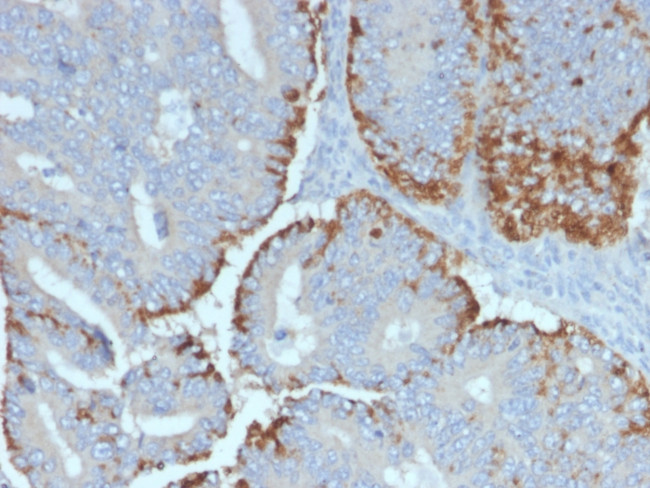 ATG5 Antibody in Immunohistochemistry (Paraffin) (IHC (P))