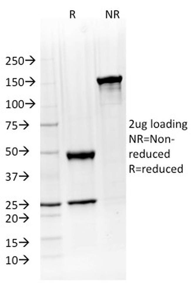 ATG5 Antibody in SDS-PAGE (SDS-PAGE)