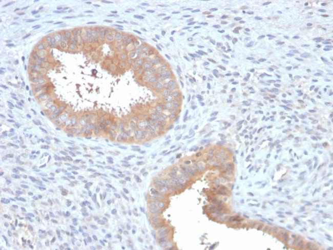 ATG5 Antibody in Immunohistochemistry (Paraffin) (IHC (P))