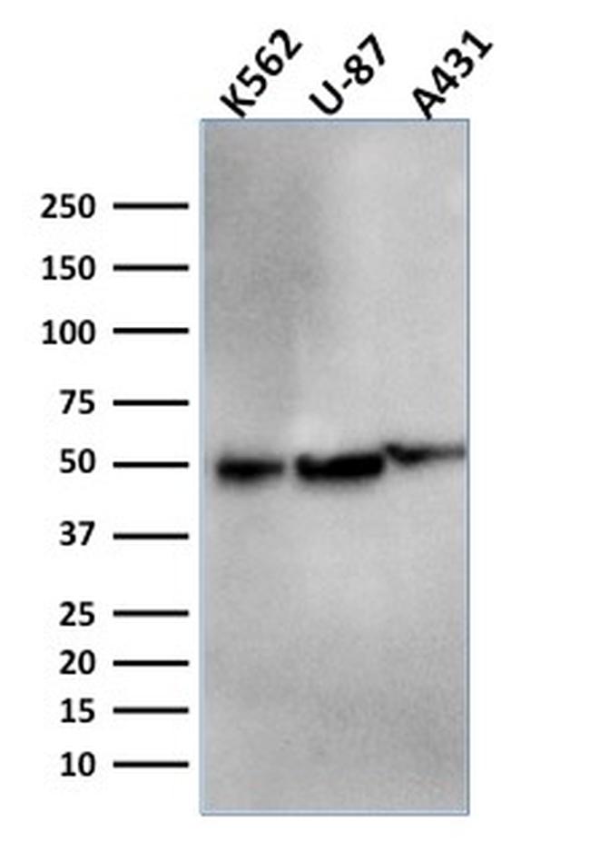 ATG5 Antibody in Western Blot (WB)
