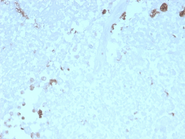 ATG5 Antibody in Immunohistochemistry (Paraffin) (IHC (P))