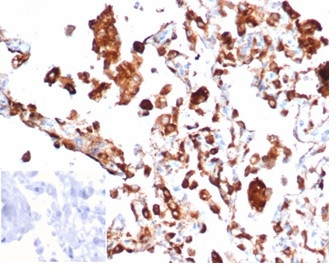 Napsin A Antibody in Immunohistochemistry (Paraffin) (IHC (P))