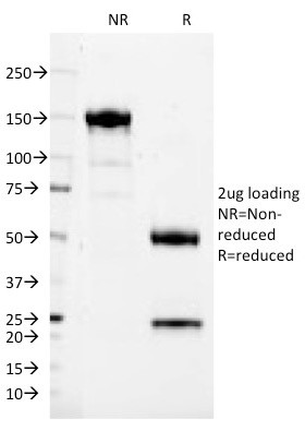 CD37 (Peripheral Mature B-Cell Marker) Antibody in SDS-PAGE (SDS-PAGE)