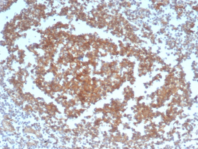 CD40/TNFRSF5/CD40L-Receptor Antibody in Immunohistochemistry (Paraffin) (IHC (P))