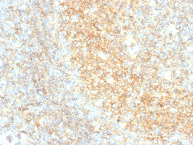 CD40/TNFRSF5/CD40L-Receptor Antibody in Immunohistochemistry (Paraffin) (IHC (P))