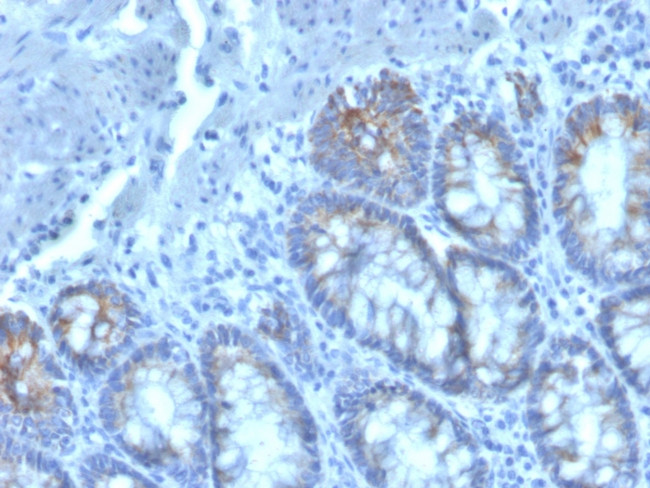 CD40 Ligand/CD154/TRAP1 (Activation Marker of T-Lymphocytes) Antibody in Immunohistochemistry (Paraffin) (IHC (P))