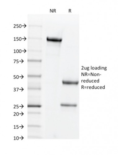 CD44v6 (Marker of Tumor Metastasis) Antibody in SDS-PAGE (SDS-PAGE)