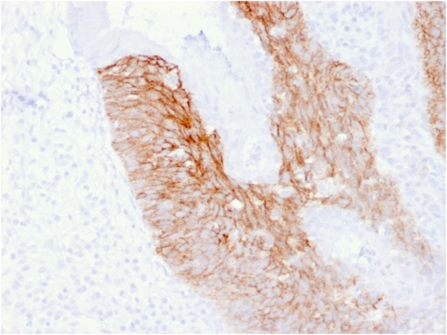 CD44v6 Antibody in Immunohistochemistry (Paraffin) (IHC (P))