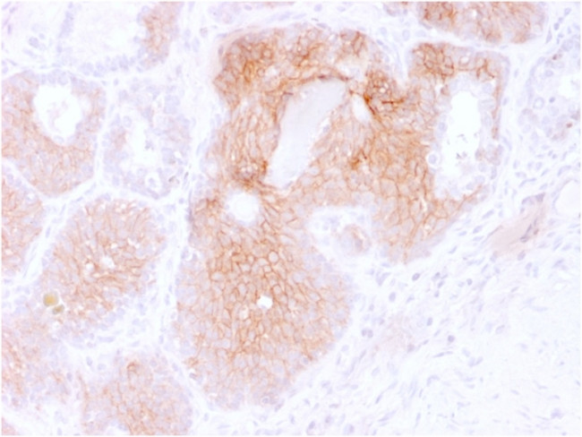 CD44v6 Antibody in Immunohistochemistry (Paraffin) (IHC (P))