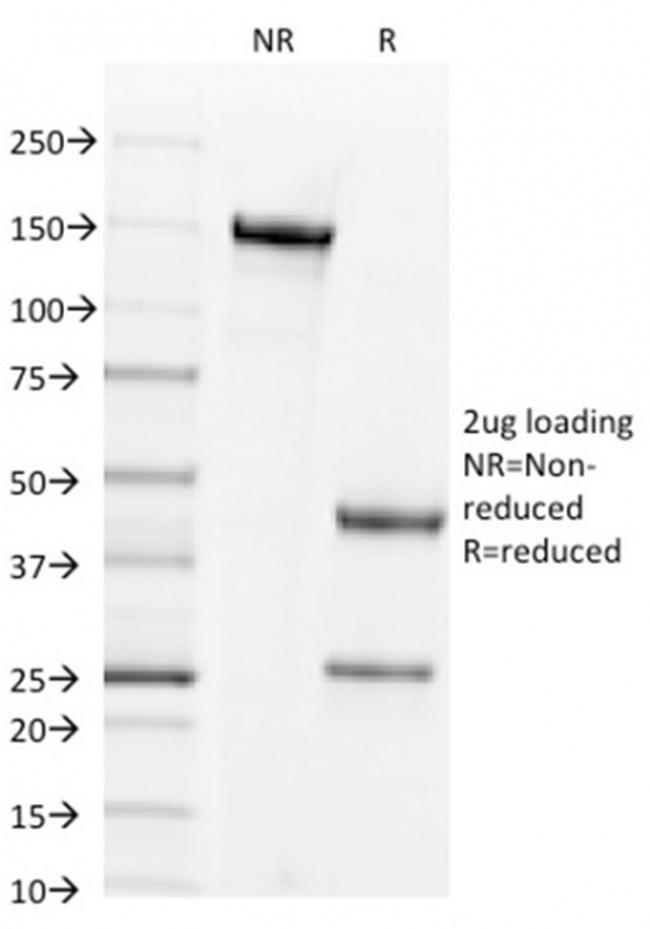 CD44v6 Antibody in SDS-PAGE (SDS-PAGE)