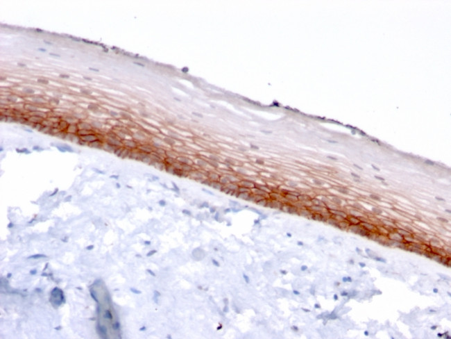 CD44v4/5 (Marker of Tumor Metastasis) Antibody in Immunohistochemistry (Paraffin) (IHC (P))