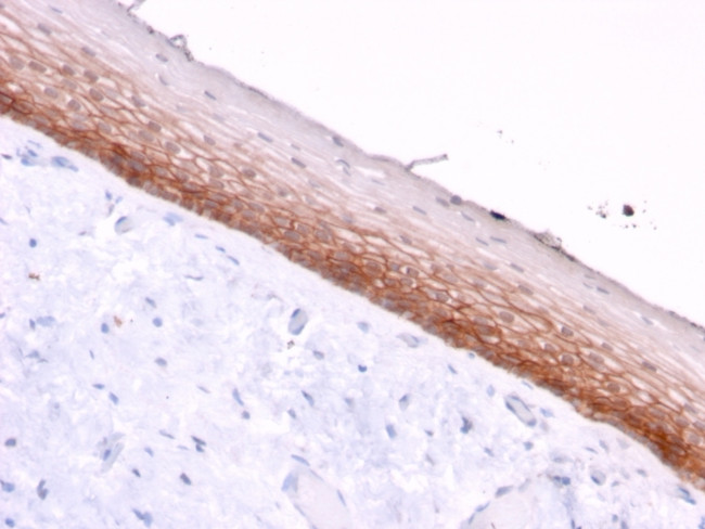 CD44v4/5 (Marker of Tumor Metastasis) Antibody in Immunohistochemistry (Paraffin) (IHC (P))