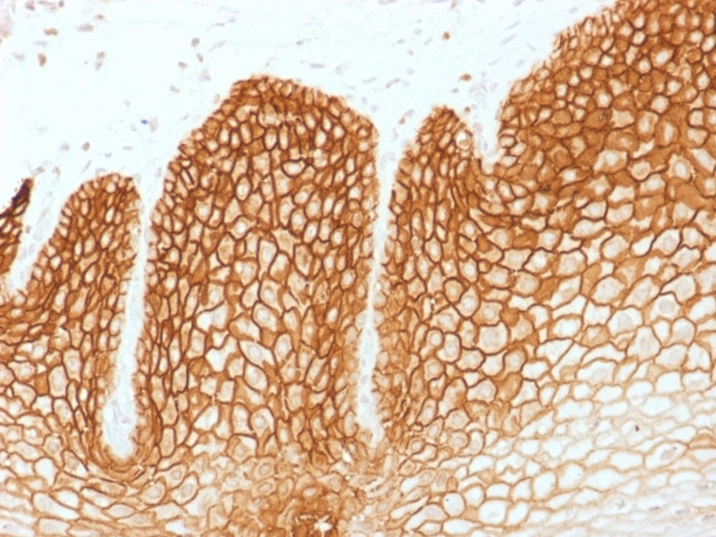 CD44v6 Antibody in Immunohistochemistry (Paraffin) (IHC (P))