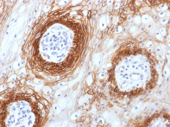 CD44v6 Antibody in Immunohistochemistry (Paraffin) (IHC (P))