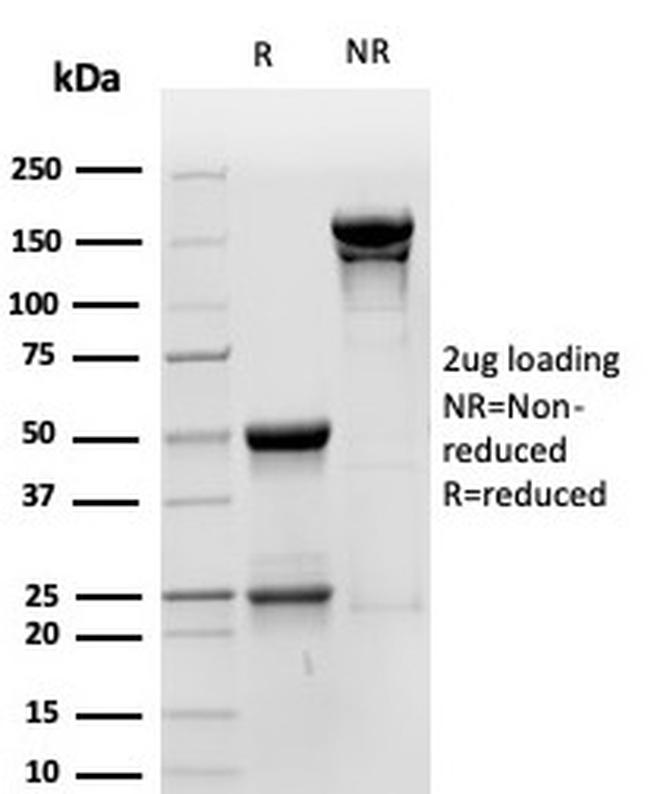 CD44v6 Antibody in SDS-PAGE (SDS-PAGE)