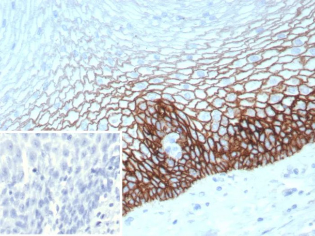 CD44v6 (Marker of Tumor Metastasis) Antibody in Immunohistochemistry (Paraffin) (IHC (P))