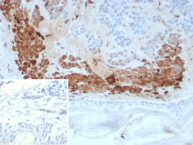 KLK4/Kallikrein related peptidase 4 Antibody in Immunohistochemistry (Paraffin) (IHC (P))