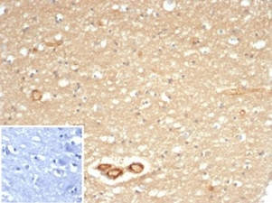 CD59/Complement Regulatory Protein/Protectin Antibody in Immunohistochemistry (Paraffin) (IHC (P))