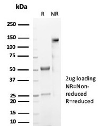 CD59/Complement Regulatory Protein/Protectin Antibody in SDS-PAGE (SDS-PAGE)