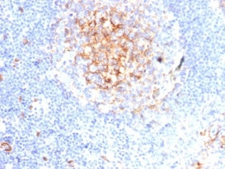 CD59/Complement Regulatory Protein/Protectin Antibody in Immunohistochemistry (Paraffin) (IHC (P))