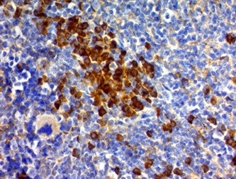 CD63 (Late Endosomes Marker) Antibody in Immunohistochemistry (Paraffin) (IHC (P))