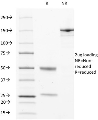 CD63 (Late Endosomes Marker) Antibody in SDS-PAGE (SDS-PAGE)