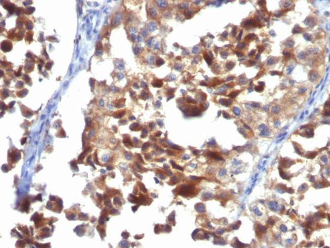 CD63 (Late Endosomes Marker) Antibody in Immunohistochemistry (Paraffin) (IHC (P))