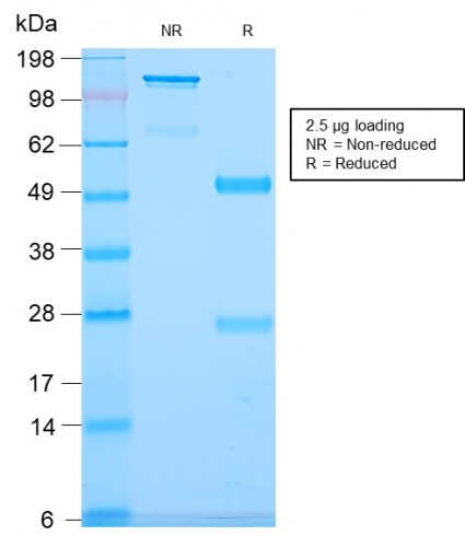 CD79b (B-Cell Marker) Antibody in SDS-PAGE (SDS-PAGE)