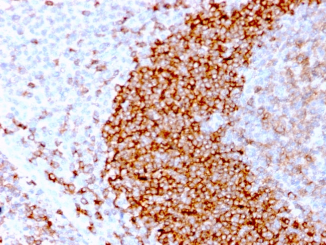 CD79b Antibody in Immunohistochemistry (Paraffin) (IHC (P))