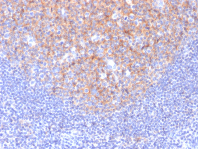 CD81/TAPA-1 Antibody in Immunohistochemistry (Paraffin) (IHC (P))