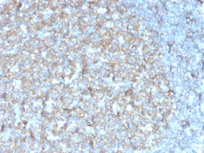 CD81/TAPA-1 Antibody in Immunohistochemistry (Paraffin) (IHC (P))