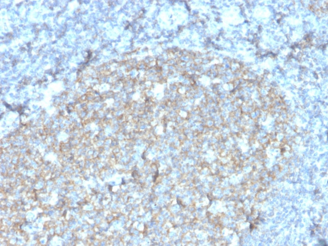 CD81/TAPA-1 Antibody in Immunohistochemistry (Paraffin) (IHC (P))