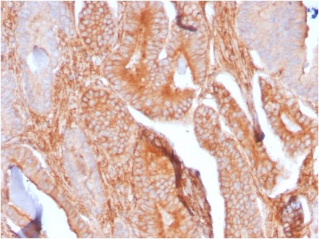 CD81/TAPA-1 Antibody in Immunohistochemistry (Paraffin) (IHC (P))