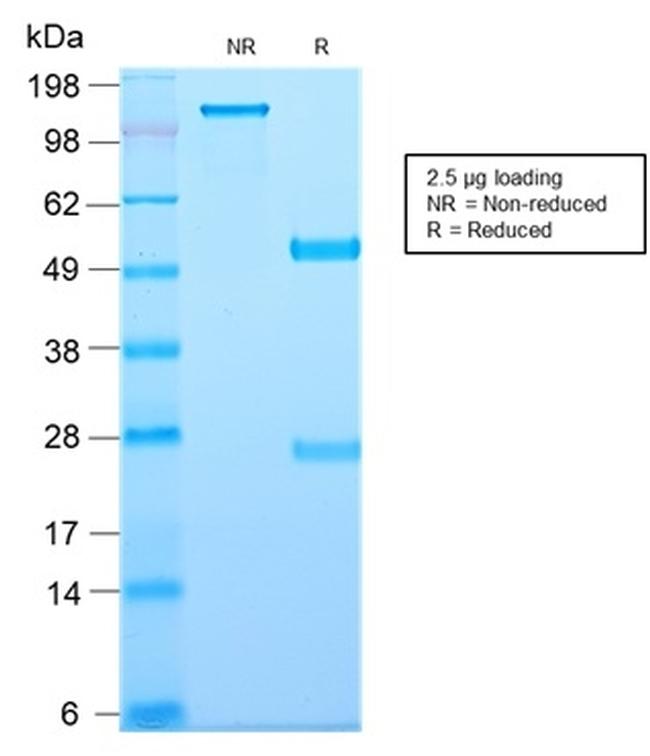 CD81/TAPA-1 Antibody in SDS-PAGE (SDS-PAGE)