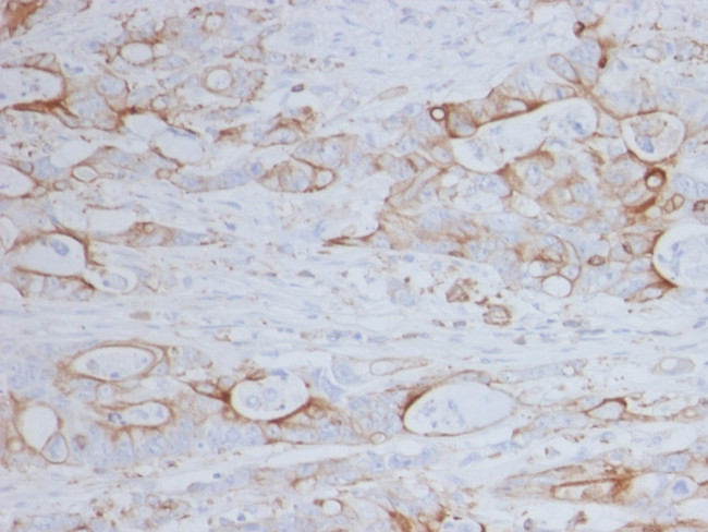 CD151 Antibody in Immunohistochemistry (Paraffin) (IHC (P))