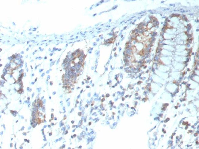 CD151 Antibody in Immunohistochemistry (Paraffin) (IHC (P))