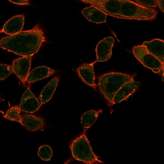 ZBTB39/ZNF922/KIAA0352 Antibody in Immunocytochemistry (ICC/IF)