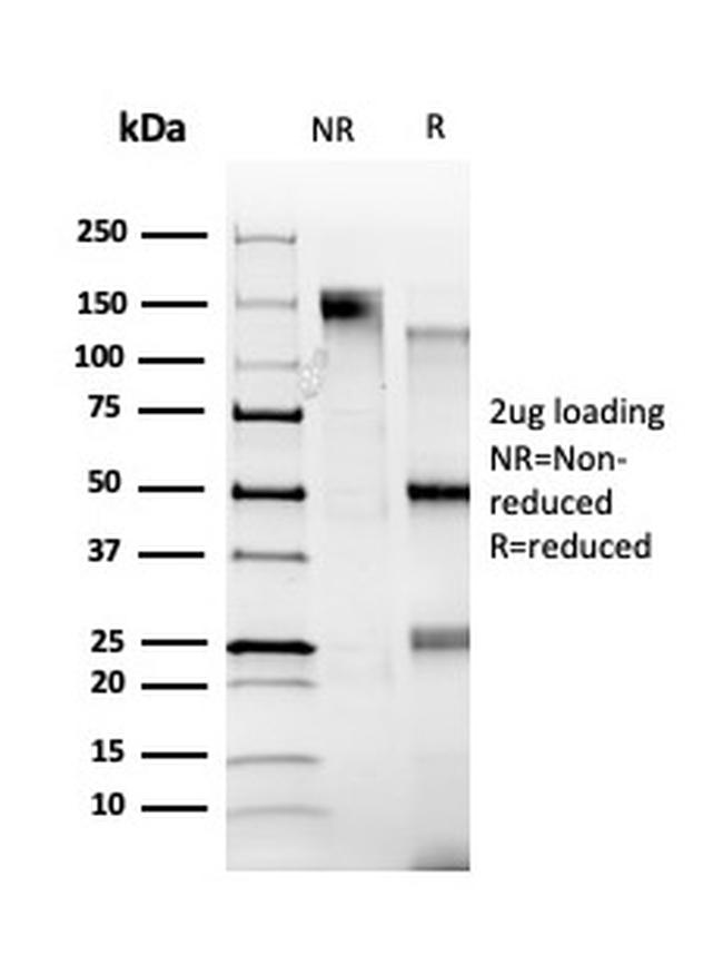 ZBTB39/ZNF922/KIAA0352 Antibody in SDS-PAGE (SDS-PAGE)