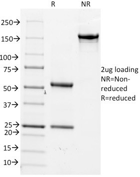 Cdc20 (Cell Division Cycle Protein 20) Antibody in SDS-PAGE (SDS-PAGE)